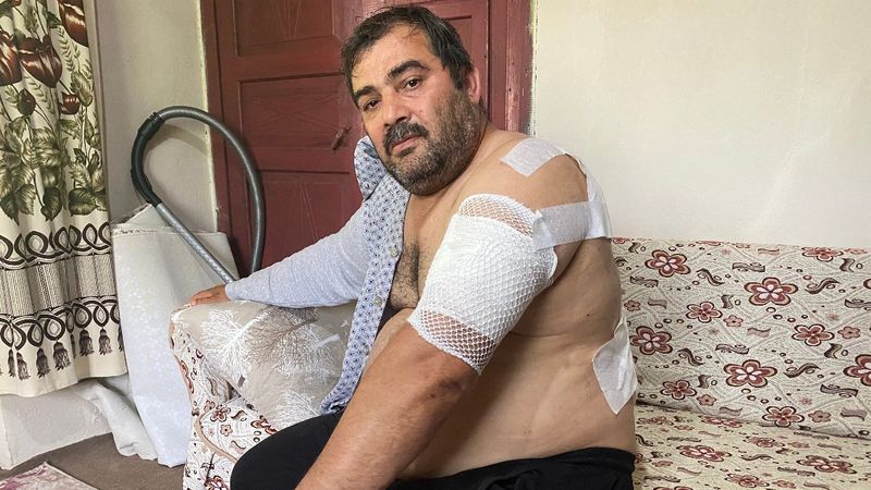 Bartın'daki vatandaşa ayı saldırdı