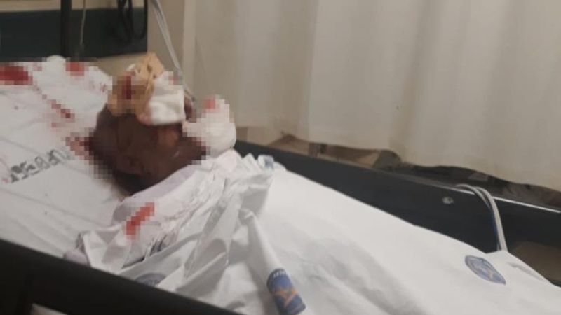 Antalya'da komşusunun köpeği tarafından saldırıya uğradı