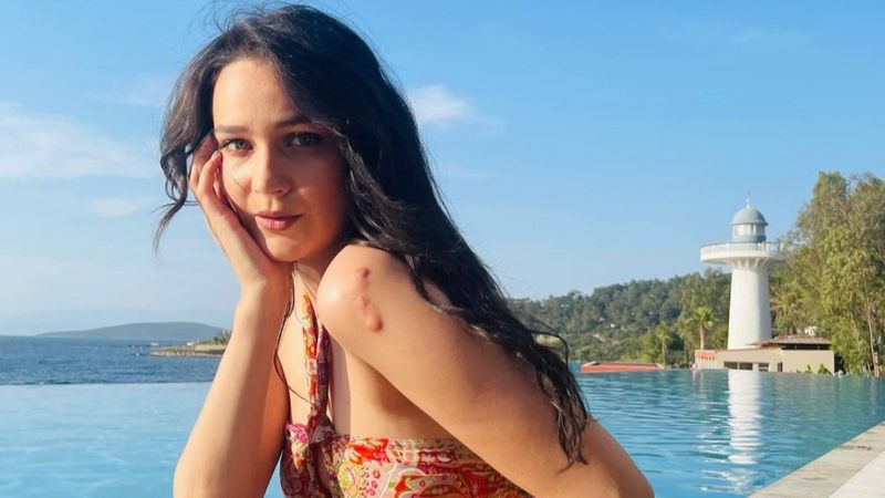 Gönül Dağı'nın Dilek'i havuz başında güneş banyosu yaptı, kolundaki iz dikkat çekti! 'Pürüzsüz tenine ne oldu'