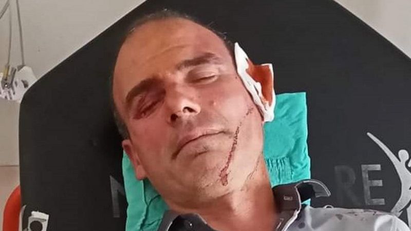 İzmir'de, hasta yakınları güvenlik görevlisini darbetti