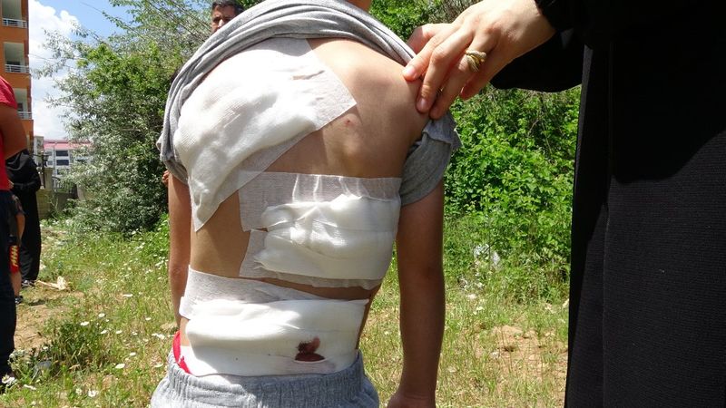 Bingöl'de başıboş köpek dehşeti: 6 yaşındaki çocuğa saldırdılar