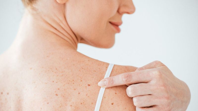 6 adımda cilt kanseri tespiti