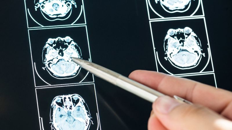 Tespit edilmesi zor 7 kanser türü