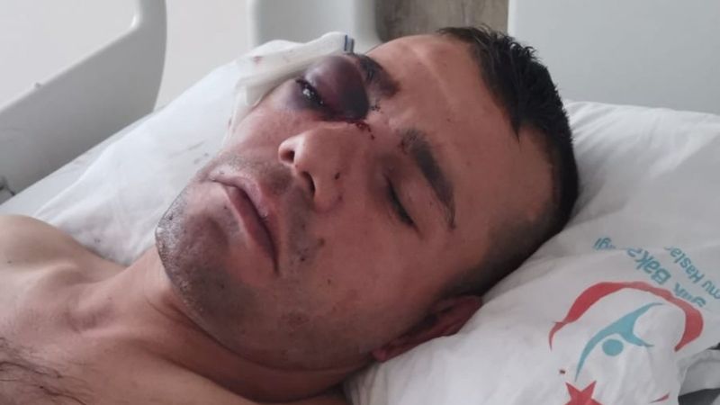 Antalya'da yüzde 40 engelli adamı öldüresiye dövüp gözünden ettiler