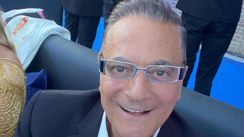 Mehmet Ali Erbil'in sivilcesi için ödediği para olay oldu! 'Allah düşürmesin'