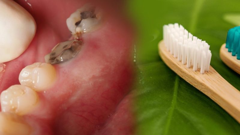 Anında etki ediyor! Diş çürüklerini durduran 10 bitki...