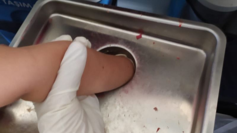 Nevşehir'de 4 yaşındaki çocuk elini kıyma makinesine kaptırdı