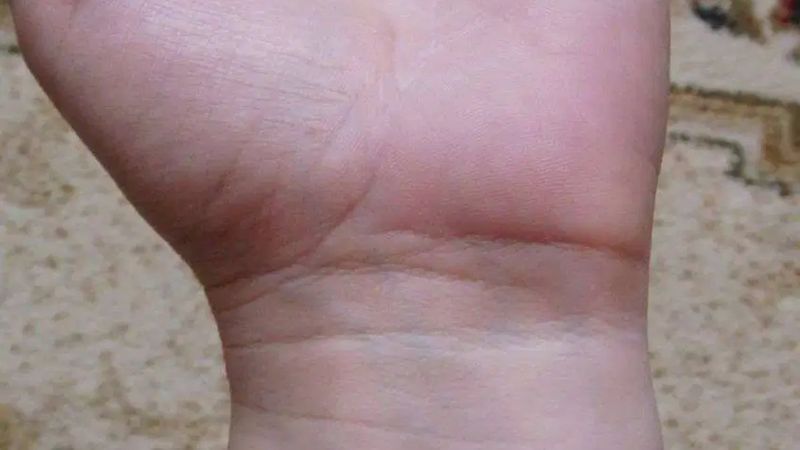 Bilek çizgileri meğer çok anlamlıymış! Herkeste farklı! '4 olan yaşadı...'