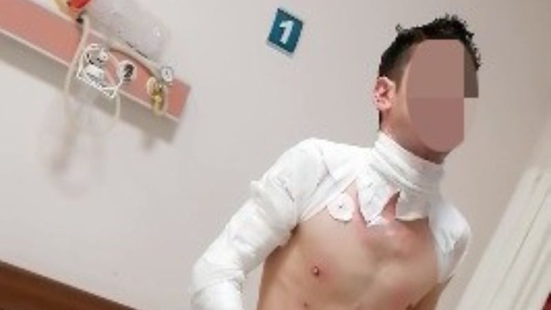 Antalya'da ambulans geç geldi deyip kendini yaktı