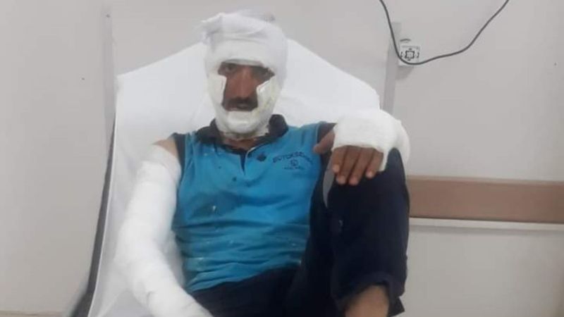 Kocaeli'de rögar kapağına kaynak yapılırken patlama yaşandı