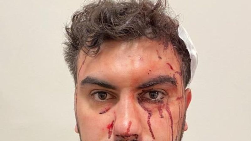 Üsküdar'da akrabaları tarafından asma kilitle darbedildi