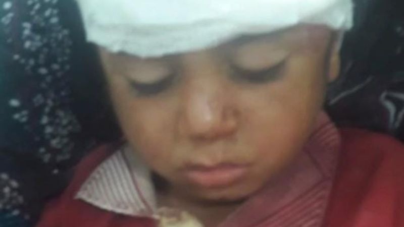 Şanlıurfa'da atın yaraladığı çocuk tedavi altında