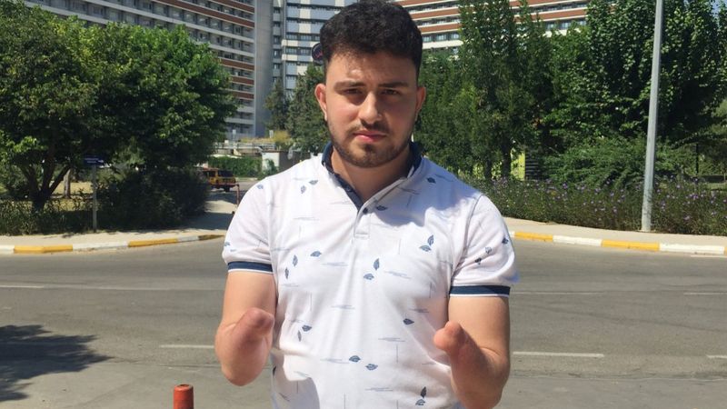 Antalya'da kol nakli bekleyen genç: Annemin ellerini tutmak istiyorum