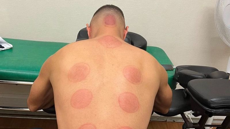 Karim Benzema hacamat yaptırdı