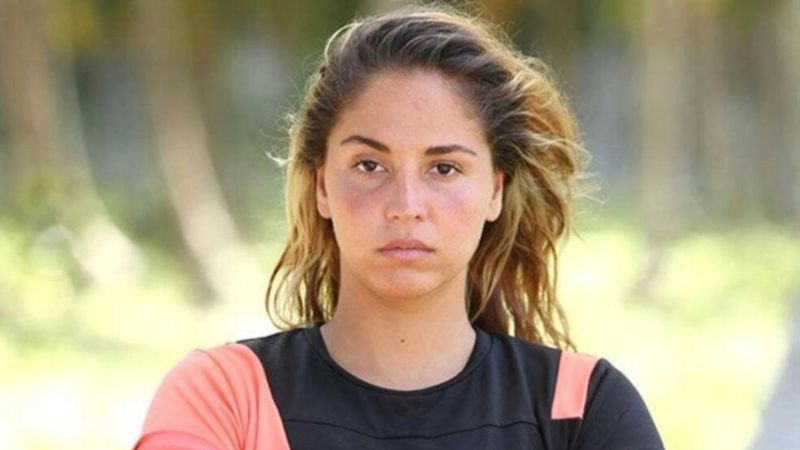 Survivor Berna'nın yırtmacı kasığını geçti... 