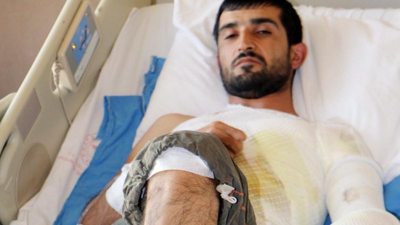 Ağrı'da çalışırken nöbet geçiren genç aşçı yandı