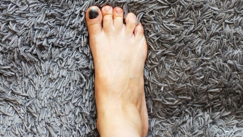 Tırnaklarınıza dikkat edin! Bu 13 belirtiden birini fark ederseniz bir sağlık sorununuz olabilir...