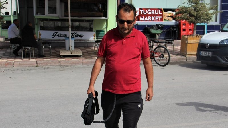 Sivas'ta yapay kalple yaşayan adam: Çantamı para dolu zannediyorlar