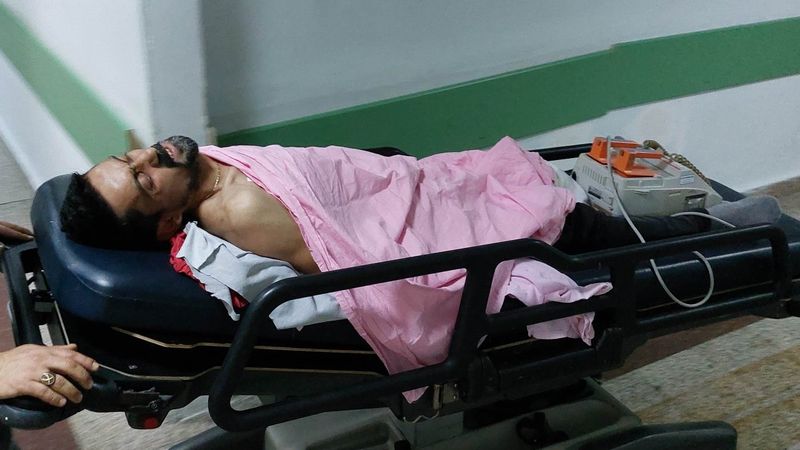 Samsun'da yemek yerken kardeşinin bıçaklı saldırısına uğradı