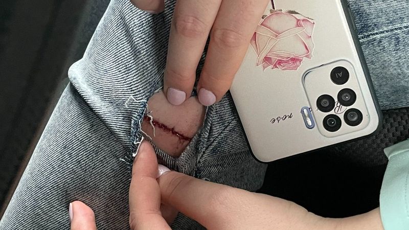 Başıboş sokak köpekleri İstanbul'da turistlere saldırdı