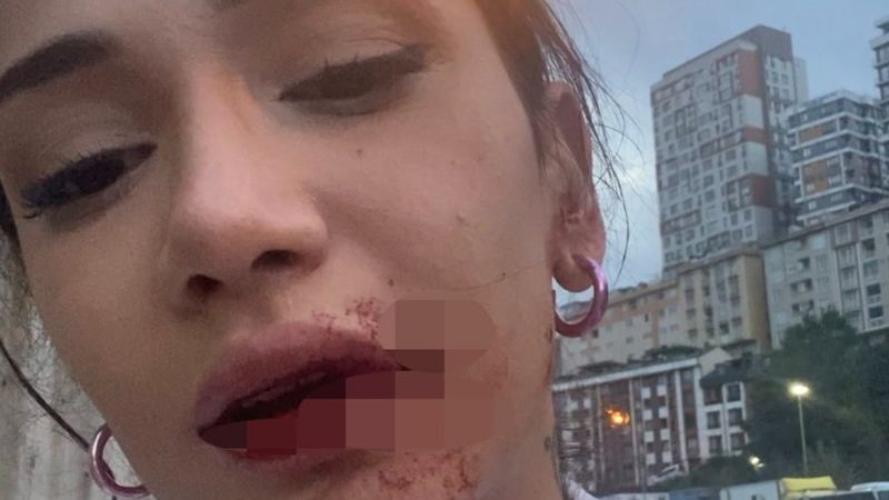 Kağıthane'de sözlü tacize uğrayan kardeşler, canice dövüldü