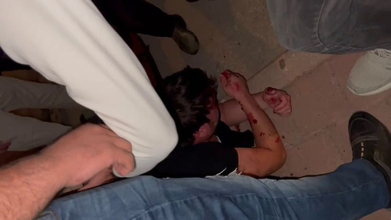 Adana'da tacizciye sokak ortasında öldüresiye darp