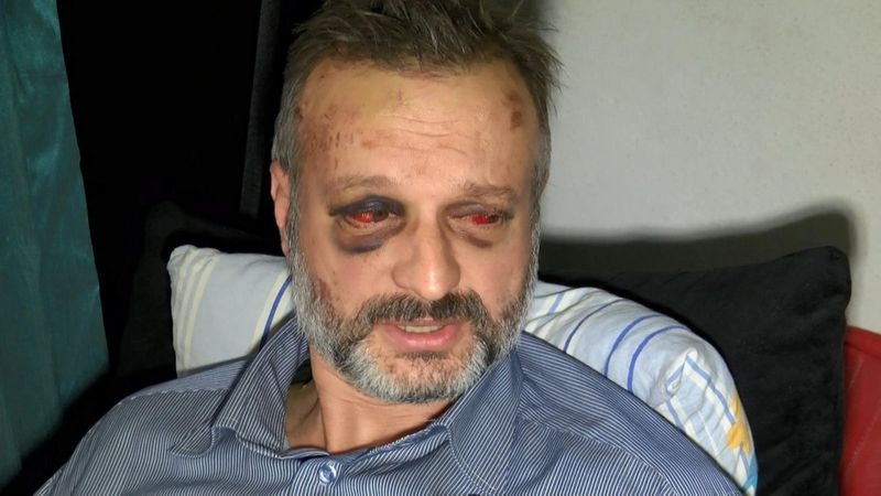 Bursa'da müzisyeni, ikinci kez 'çiftetelli' çalmayınca döven 9 kişi serbest