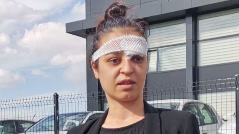 Ankara'da şiddet mağduru kadından eski kocaya suç duyurusu