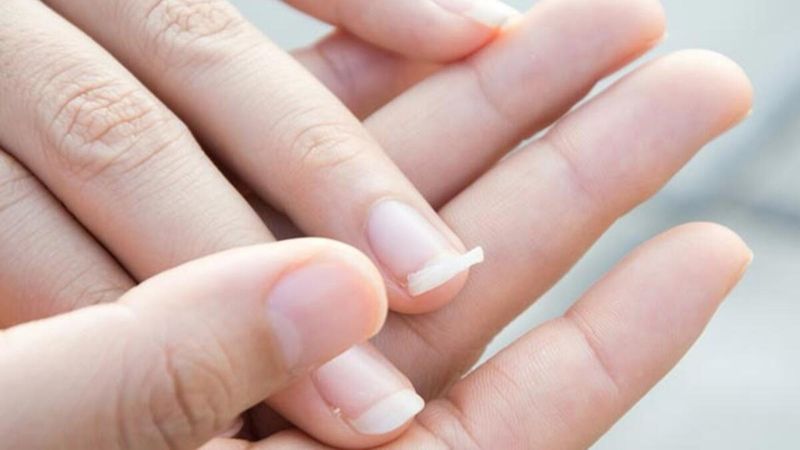 Tırnaklar neden çabuk kırılır? Tırnakları güçlendirmenin yolları