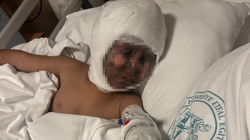 Esenyurt’ta elektrik trafosuna çatal sokan çocuk yandı