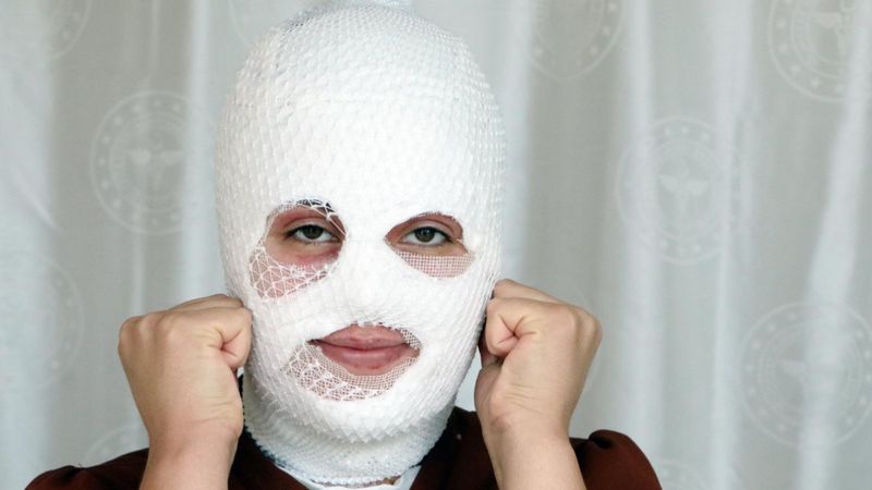 Ağrı'da düdüklü tencere patladı