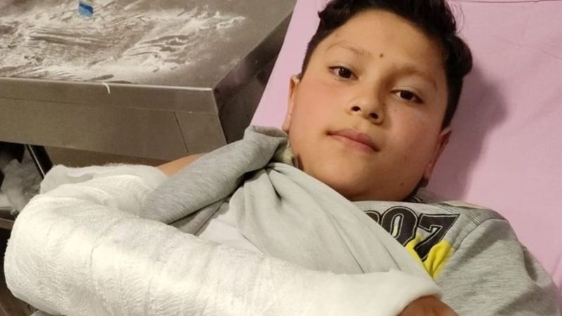 Ankara'da bir haftada 2 çocuk sokak köpeği saldırısına uğradı 