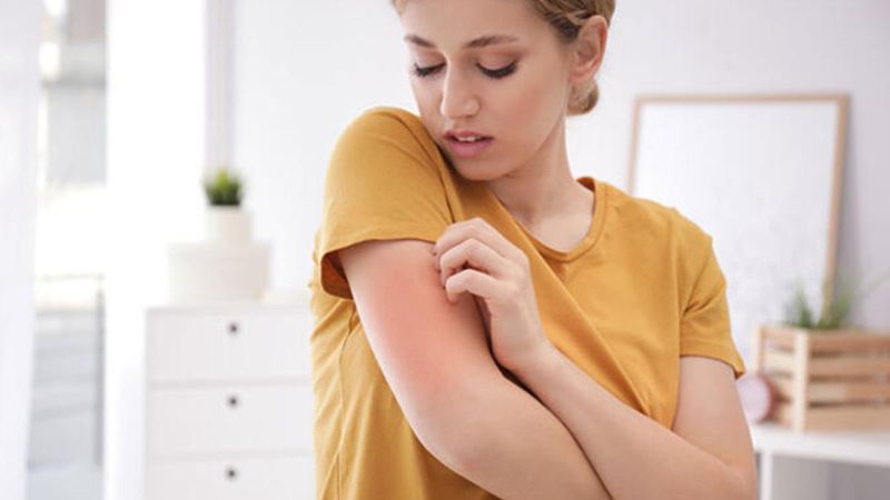 Uyuz hastalığı nedir, belirtileri ve tedavi yöntemleri nelerdir