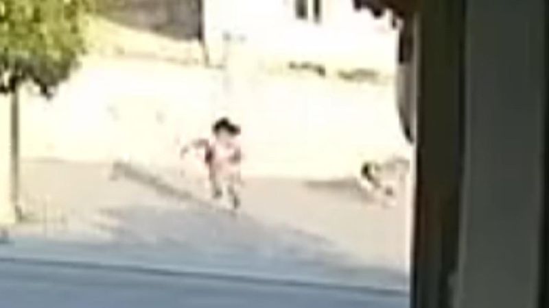 Şanlıurfa'da köpeklerin saldırdığı minik kız ölümden döndü