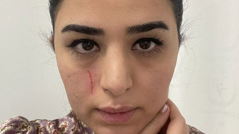 Mersin'de kadın doktoru darbeden iki sanık serbest kaldı