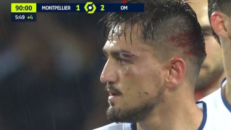 Montpellier maçında kaşı açılan Cengiz Ünder son durumunu paylaştı