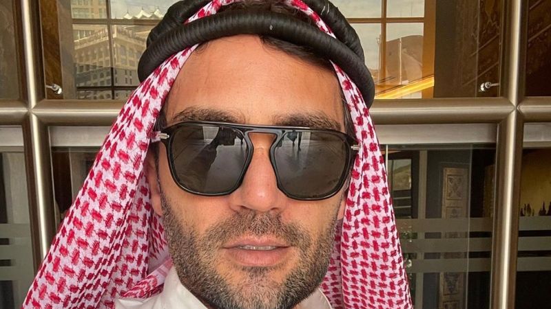 Yaşar İpek, çenesini yaptırdı