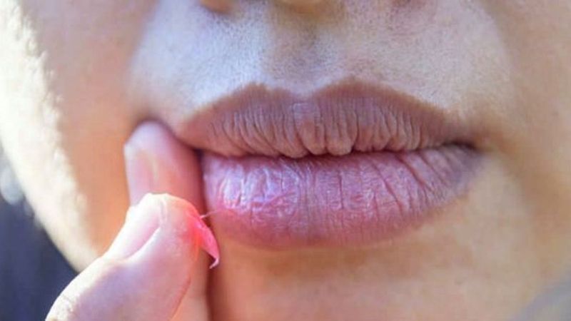 Dudağınız morarıyorsa dikkat! İşte dudak morarmasının sebebi ve tedavisi...