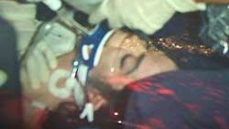 Jackson Kardiyak Arrestten öldü