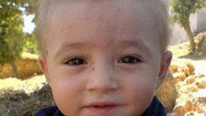 Çocuklarda lenf bezleri neden büyür