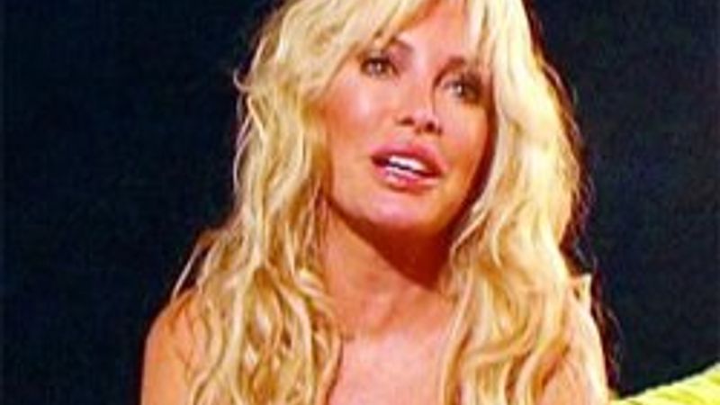 Estetiksiz bir orası kalmıştı