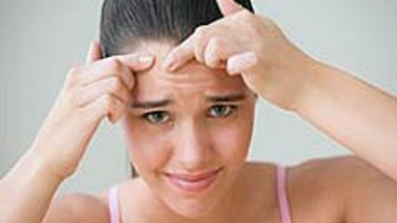 Stres sivilceye neden oluyor