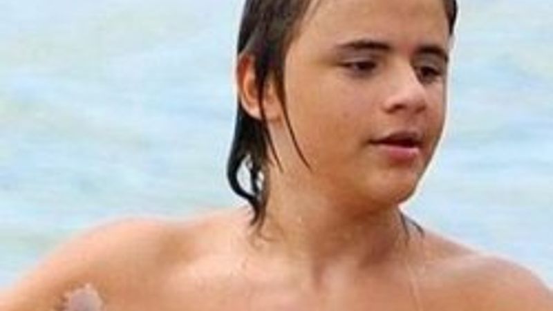 Jackson'un hastalığı oğlunada mı bulaştı