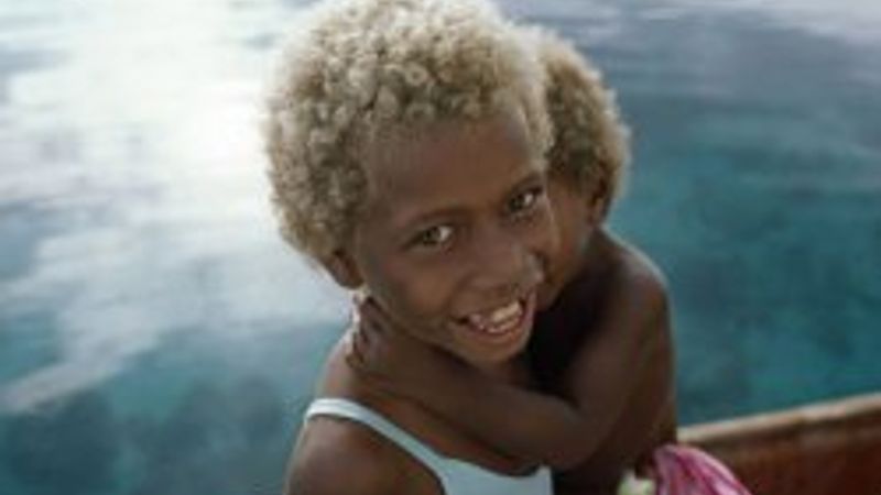 Sarı saçlı mavi gözü zenci