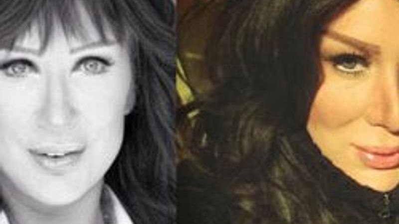 Seda Sayan'a benzemek için estetik üstüne estetik