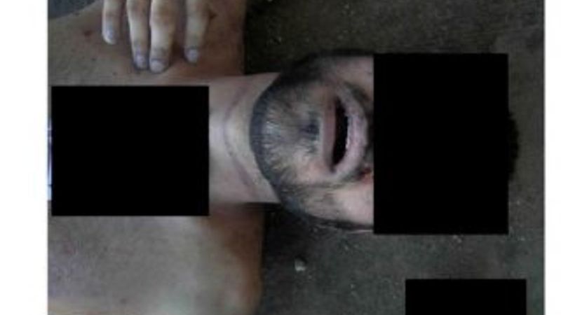 Suriye'deki vahşetten yeni fotoğraflar ortaya çıktı