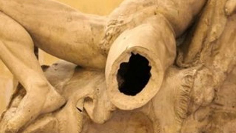 Selfie çekerken tarihi heykelin bacağını kırdı