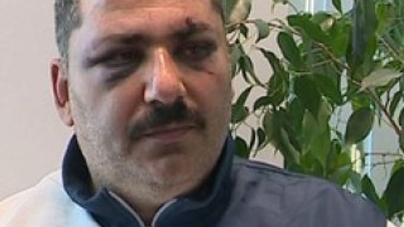 Mansur Yavaş'ın korumalarının dövdüğü adam konuştu