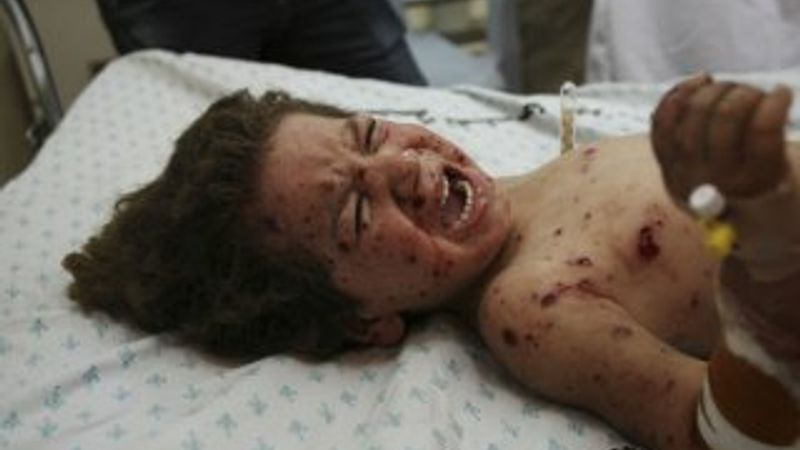 İsrail donanması sahili vurdu: 4 çocuk öldü İZLE