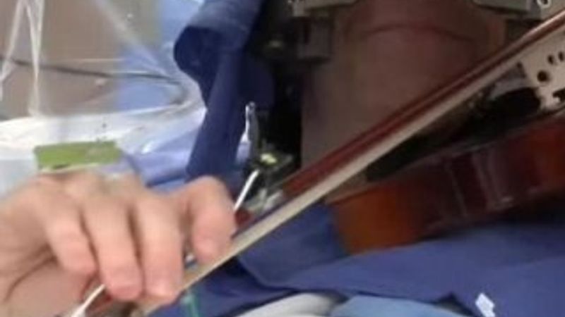 Müzisyen beyin ameliyatı olurken keman çaldı